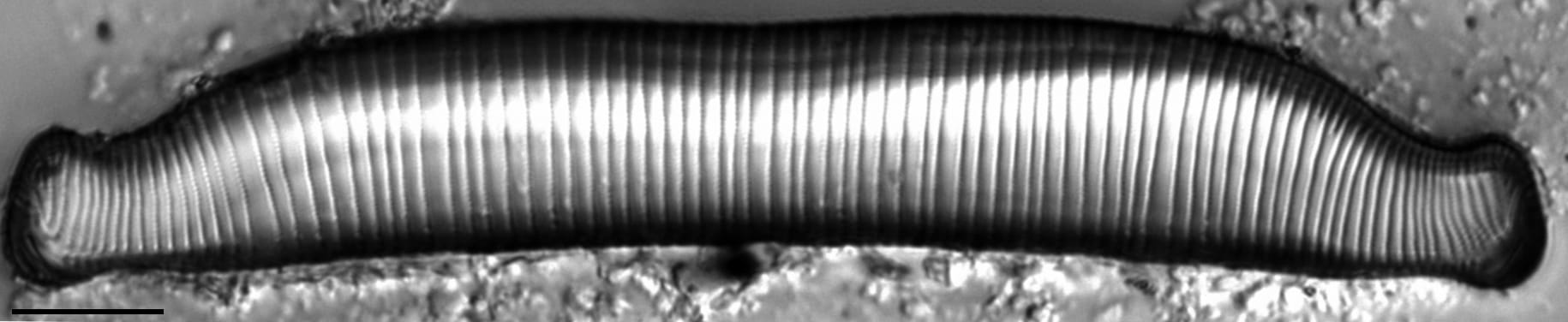 Eunotia superbidens LM2