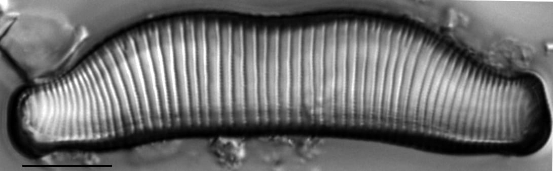 Eunotia superbidens LM4