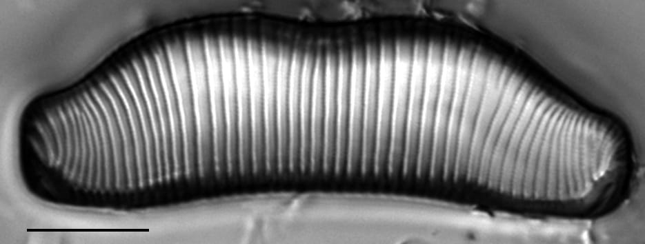 Eunotia superbidens LM5