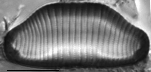 Eunotia superbidens LM7