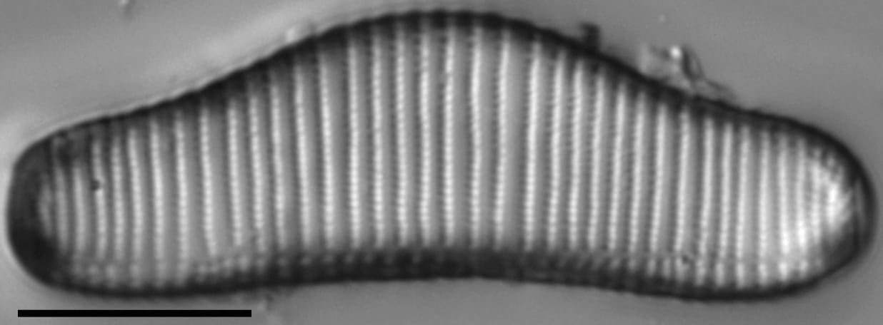 Eunotia areniverma LM2