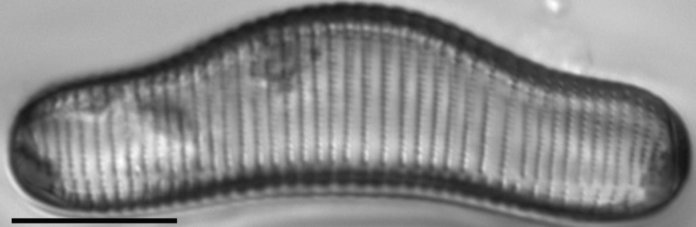 Eunotia areniverma LM3