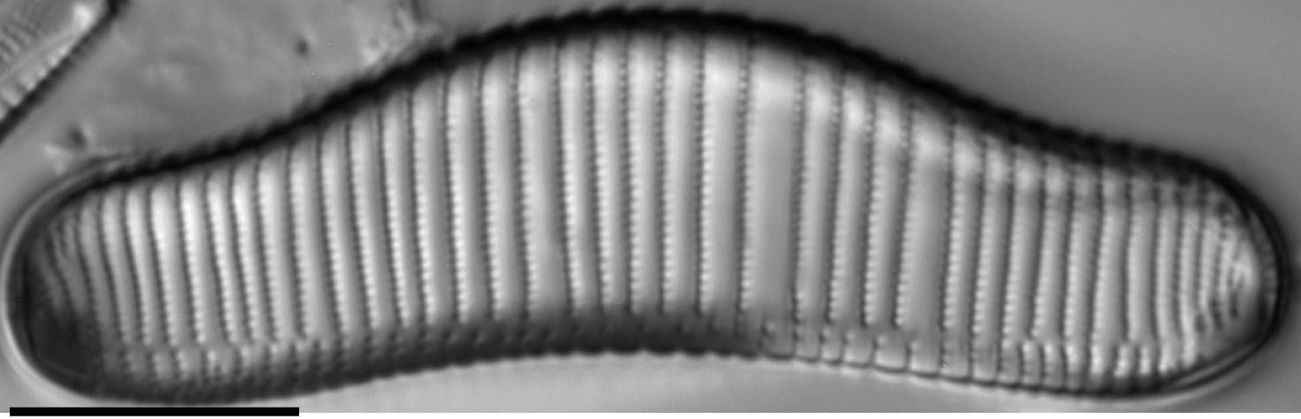 Eunotia areniverma LM4