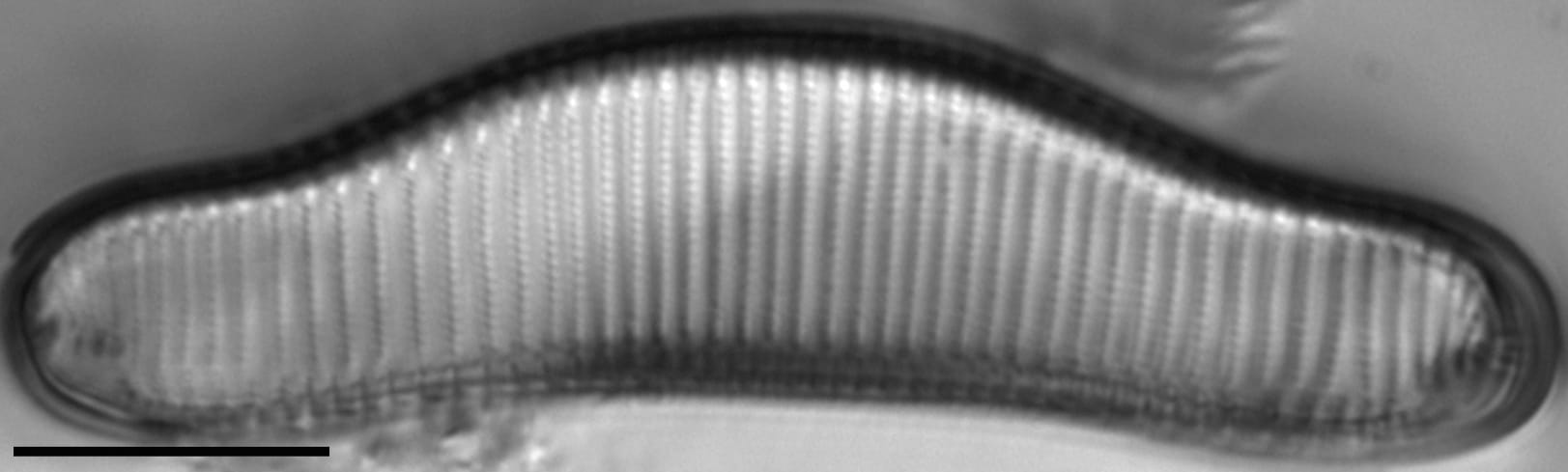 Eunotia areniverma LM5