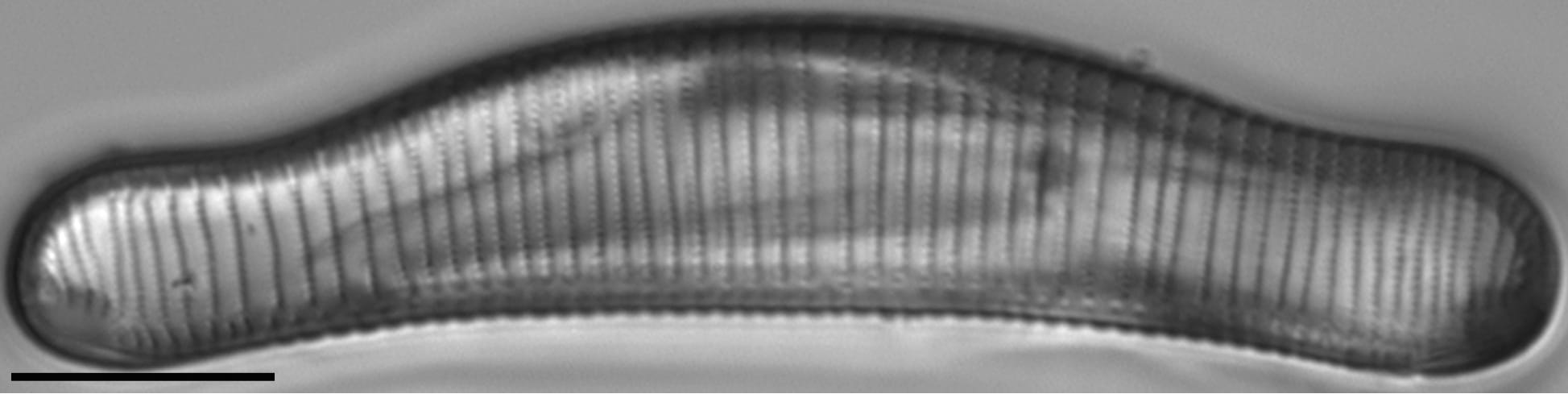 Eunotia areniverma LM6