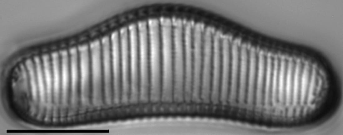 Eunotia areniverma LM1