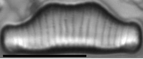 Eunotia kociolekii LM3