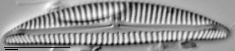 Encyonema pergracile LM5