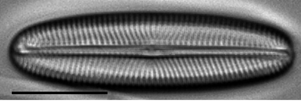 Envekadea metzeltinii LM5