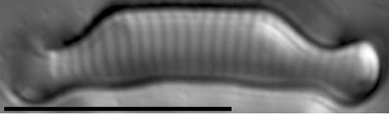 Eunotia orthohedra LM1