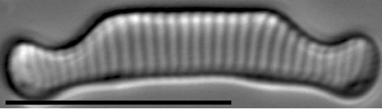 Eunotia orthohedra LM2