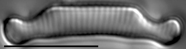 Eunotia orthohedra LM5