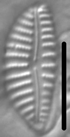 Encyonema Sp 212501 7