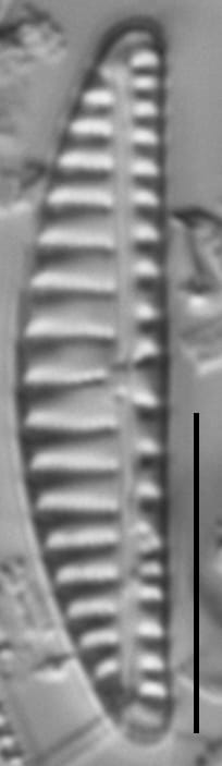 Encyonema groenlandica LM7