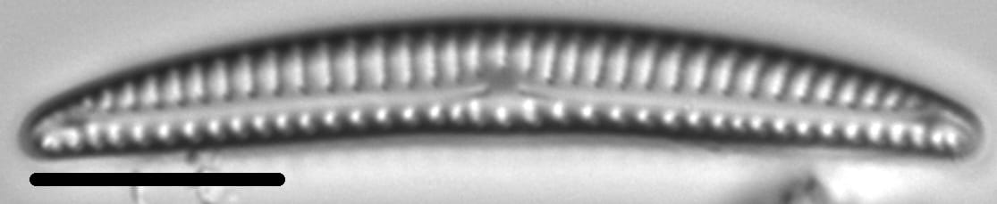 Encyonema lunatum LM2