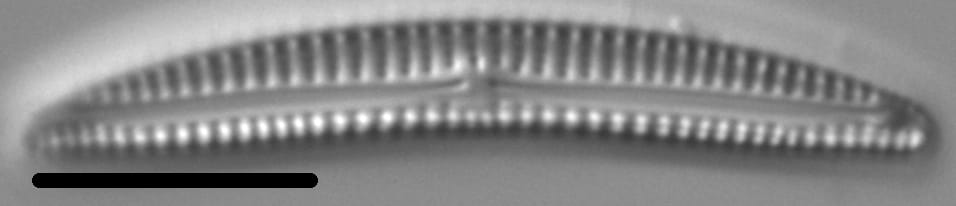 Encyonema lunatum LM6