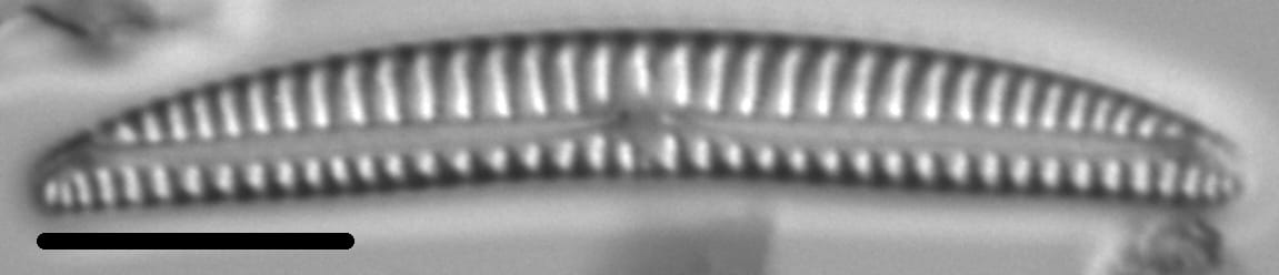 Encyonema lunatum LM1