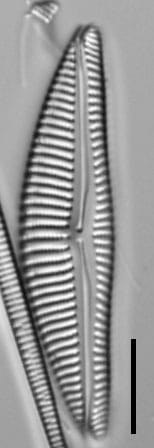 Encyonema neomesianum 07062021 SRS1d EC3 Fig6