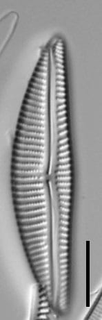 Encyonema neomesianum 07062021 SRS1d EC3 Fig7