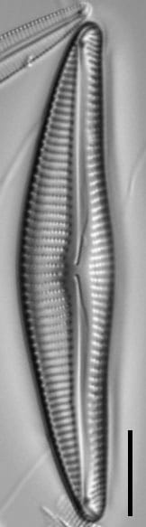 Encyonema neomesianum ever1 07062021 SRS1d EC3 Fig3