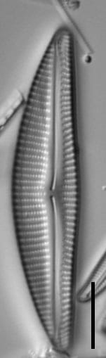 Encyonema neomesianum ever1 07062021 SRS1d EC3 Fig5