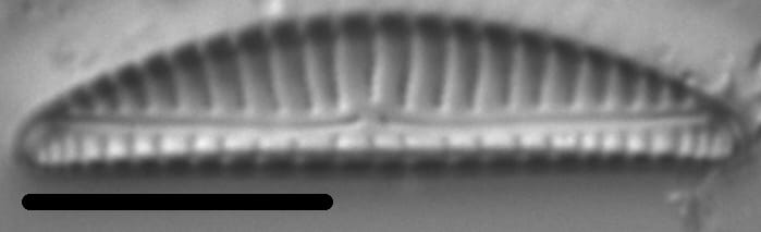 Encyonema paucistriatum LM7