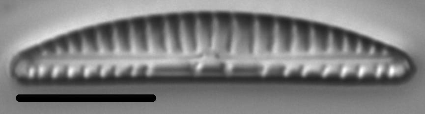 Encyonema paucistriatum LM3