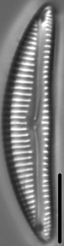 Encyonema procerum LM