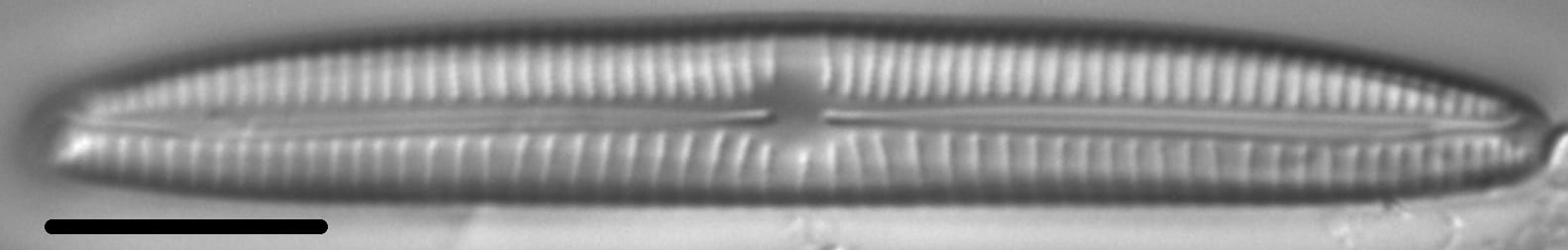 Encyonema sibericum LM1