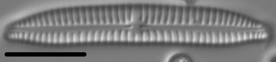 Encyonema sibericum LM5