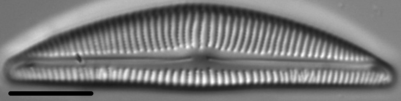 Encyonema Silesiacum LM1