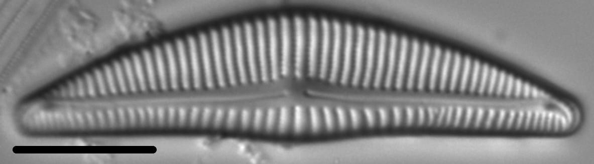 Encyonema Silesiacum LM2