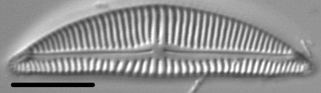 Encyonema Silesiacum LM3