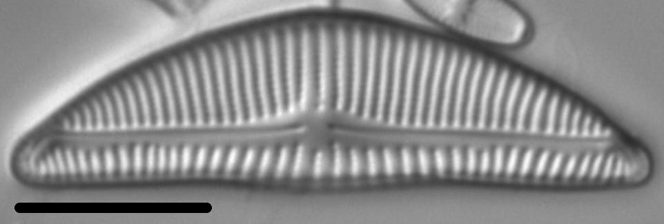 Encyonema Silesiacum LM5