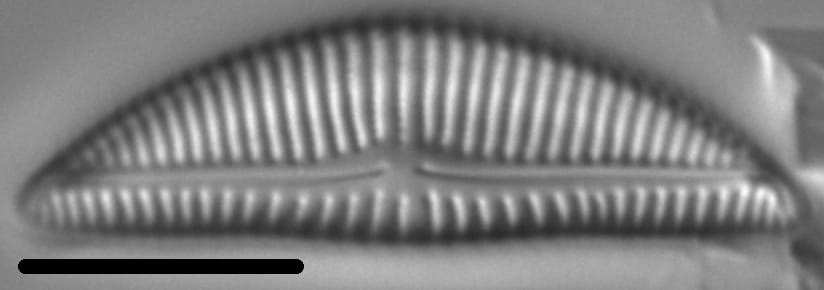 Encyonema Silesiacum LM6