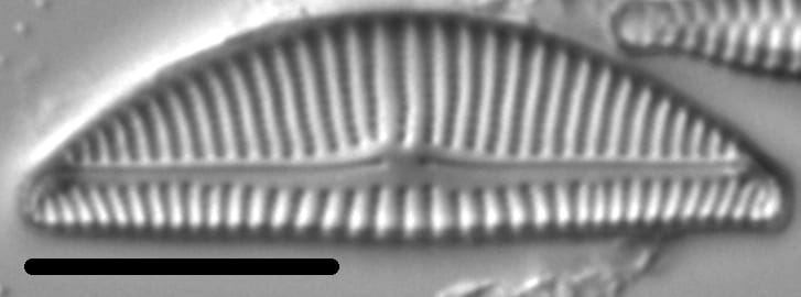 Encyonema Silesiacum LM7