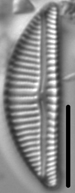 Encyonema Silesiacum LM8