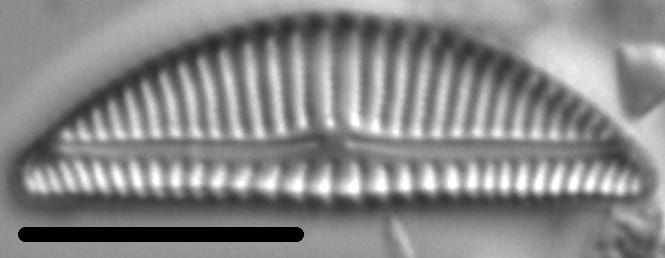 Encyonema Silesiacum LM8