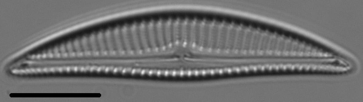 Encyonema silesiacum var elegans LM2