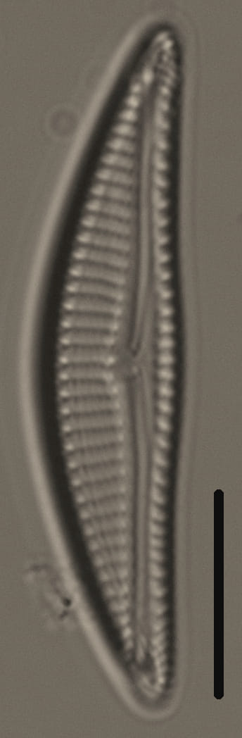 Encyonema silesiacum var elegans_FIU_CERP204853119_05