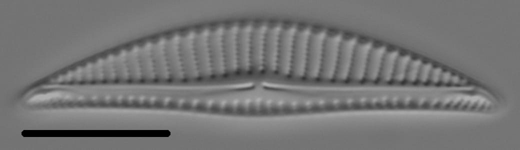 Encyonema silesiacum var elegans LM6