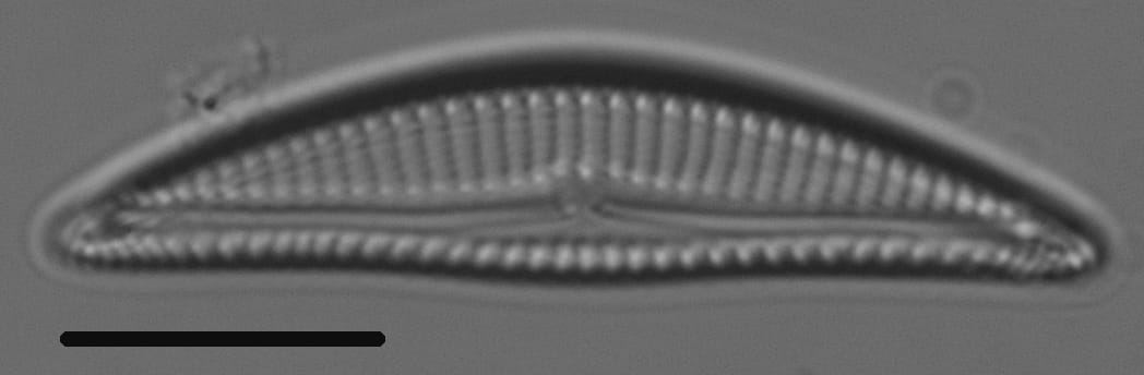 Encyonema silesiacum var elegans LM3