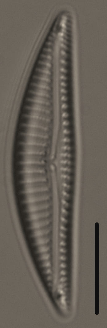 Encyonema silesiacum var elegans_FIU_CERP204853119_06