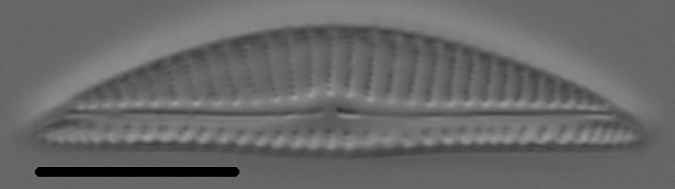 Encyonema silesiacum var elegans LM7