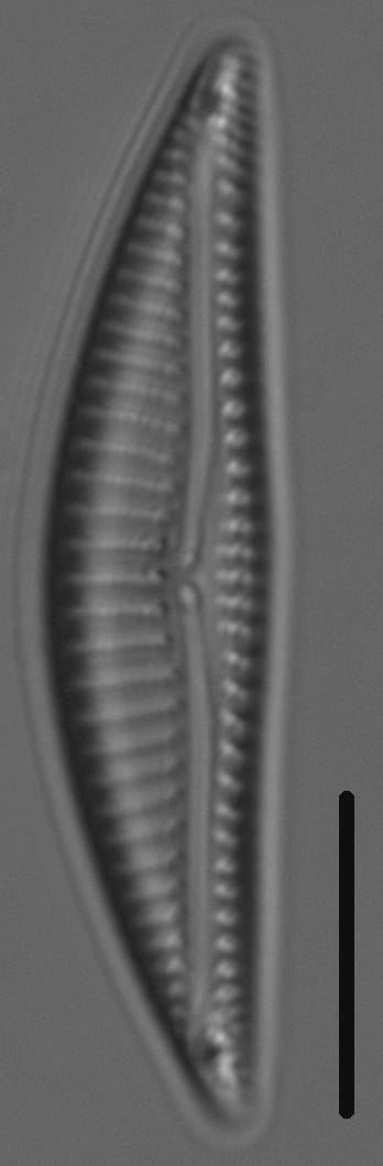 Encyonema silesiacum var elegans LM4