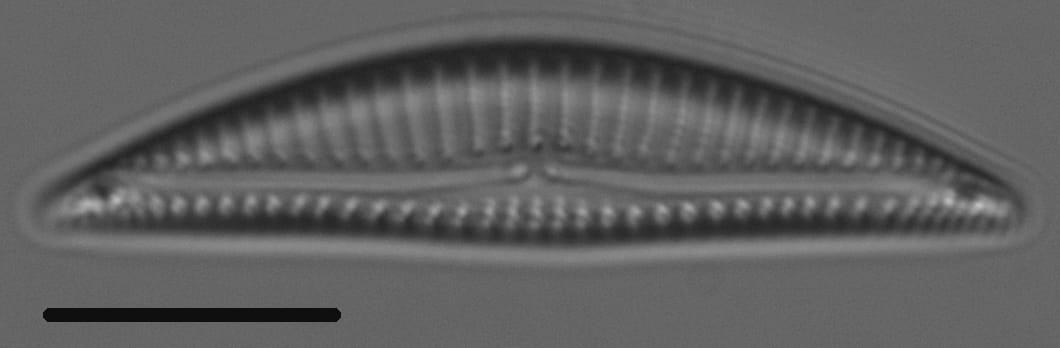 Encyonema silesiacum var elegans LM4