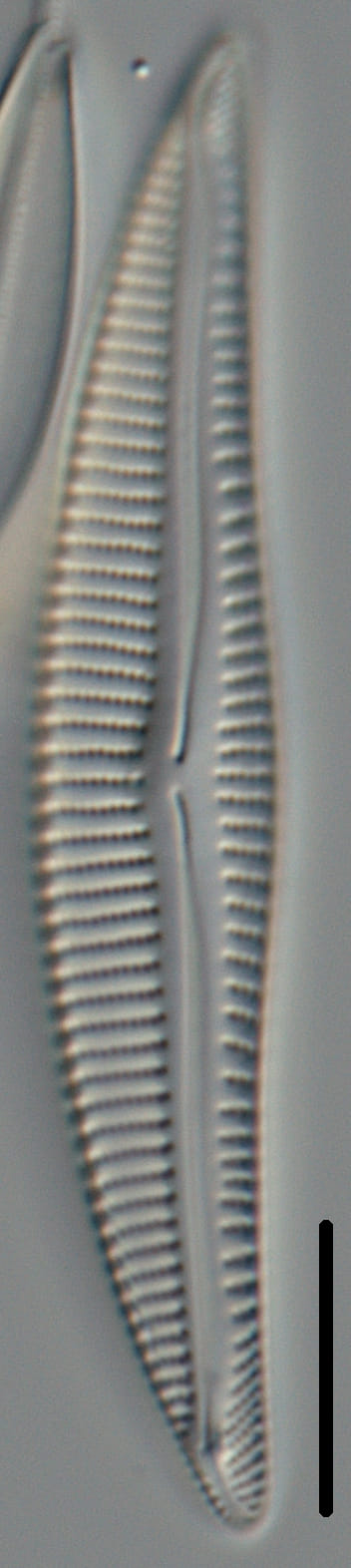 Encyonema silesiacum var elegans_FIU_CERP204853119_07