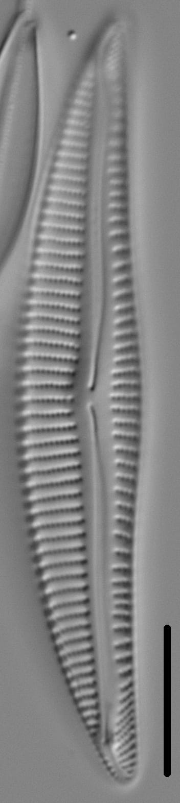 Encyonema silesiacum var elegans LM5
