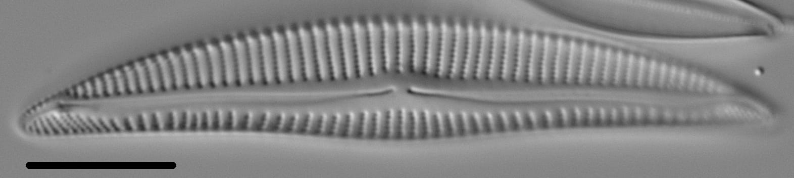 Encyonema silesiacum var elegans LM5