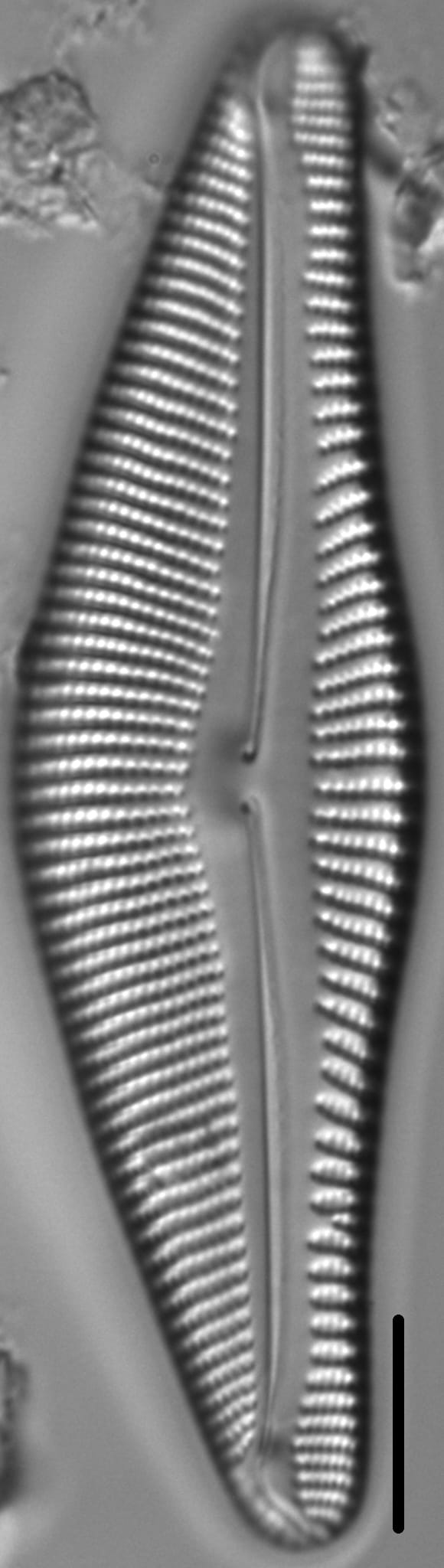 Encyonema Sp  397001 1